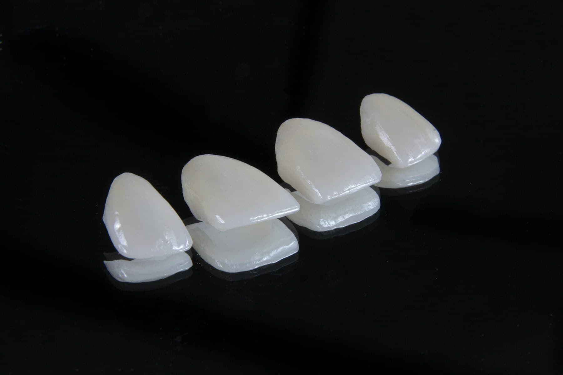 Porcelain Veneers
