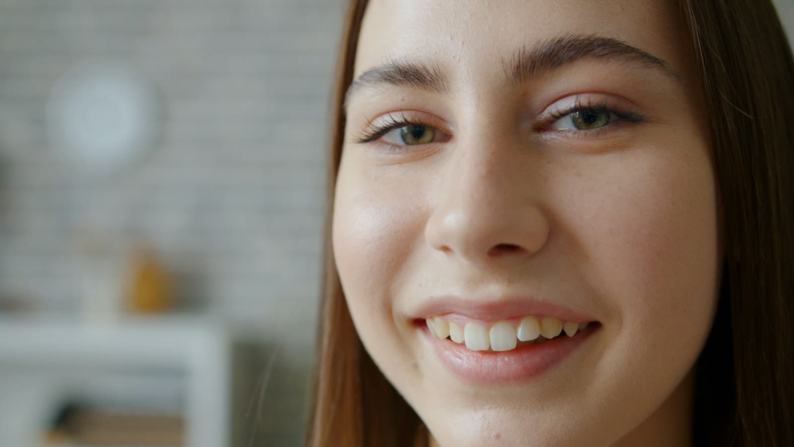 Teeth Whitening